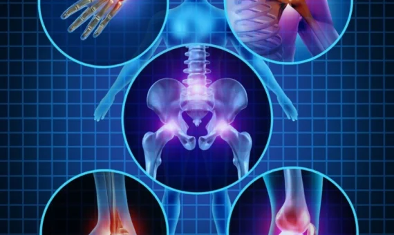 Medical illustration highlighting joints and bones affected by inflammation, focusing on the spine, hips, knees, and hands.