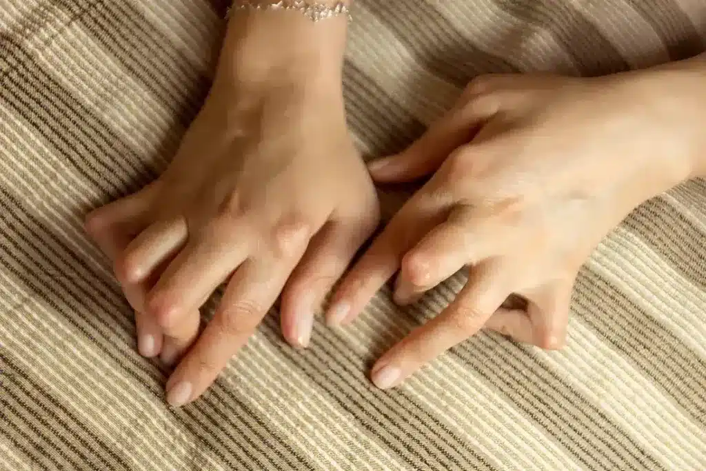 Exploring Systemic Autoimmune Diseases 2 Hands displaying fingers on striped fabric