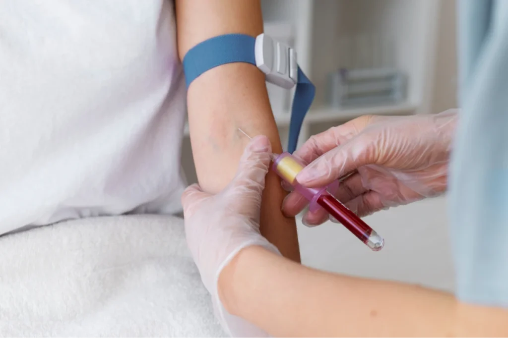 Exploring Systemic Autoimmune Diseases 7 Nurse drawing blood from a patient's arm.